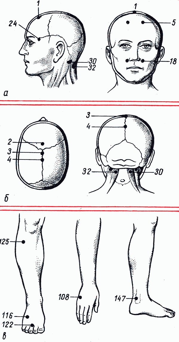 Массаж точек при головной боли схема